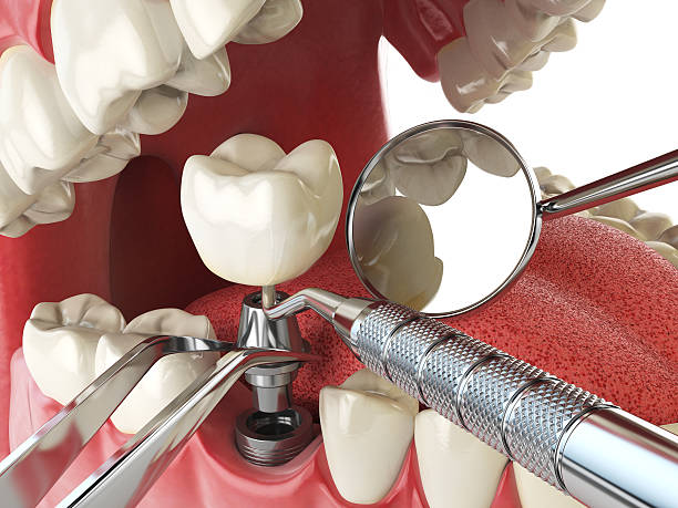Best Broken or Cracked Tooth Emergency Dentist in Cypress Landing, NC