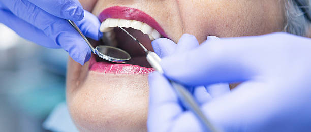 Best Emergency Dentist for Lost Fillings or Crowns in Cypress Landing, NC