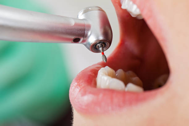Best Mobile Emergency Dentist in Cypress Landing, NC